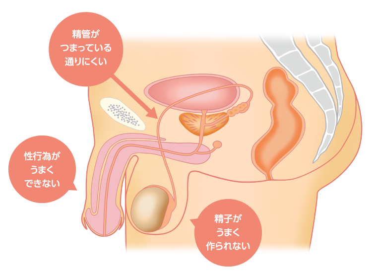 男性の原因画像